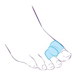 СТ-54.2 (L) Межпальцевая перегородка с кольцами