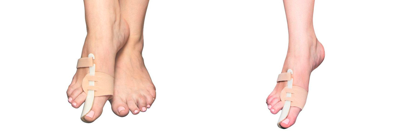 Как убрать косточку на ноге: лечение вальгусной деформации без хирургии Как убрать косточку на ноге: лечение вальгусной деформации без хирургии