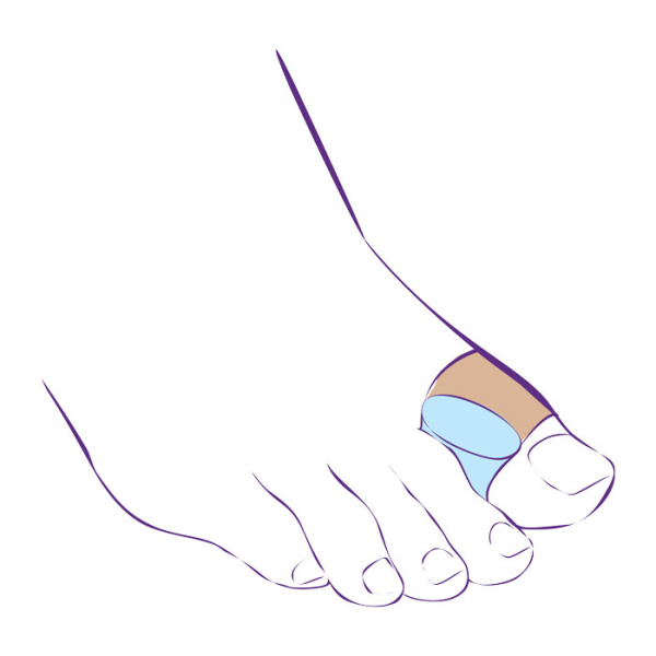 Перегородка межпальцевая с петлей на первый палец стопы на тканевой основе СТ-54.4  Trives